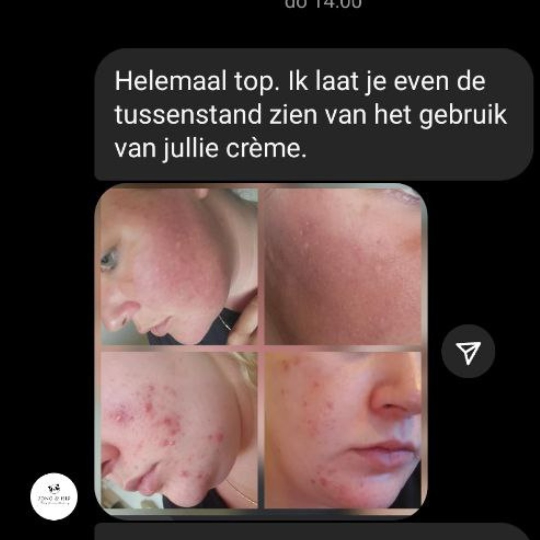 Troepvrije Gezichtscrème