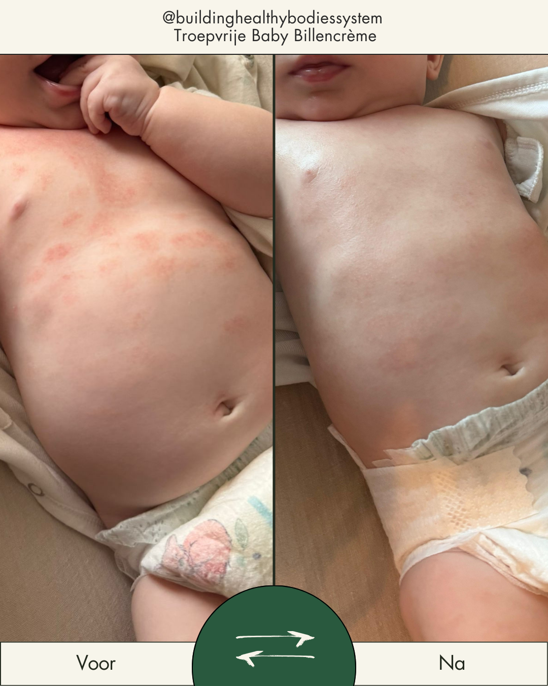 Troepvrije Baby Billencrème